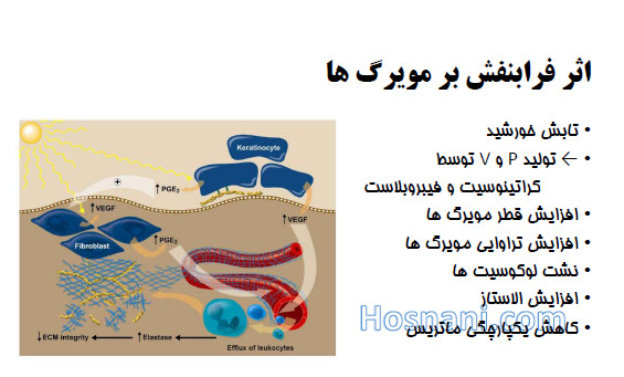 UV on microcapillaries prostaglandin VEGF elastase leukocytes