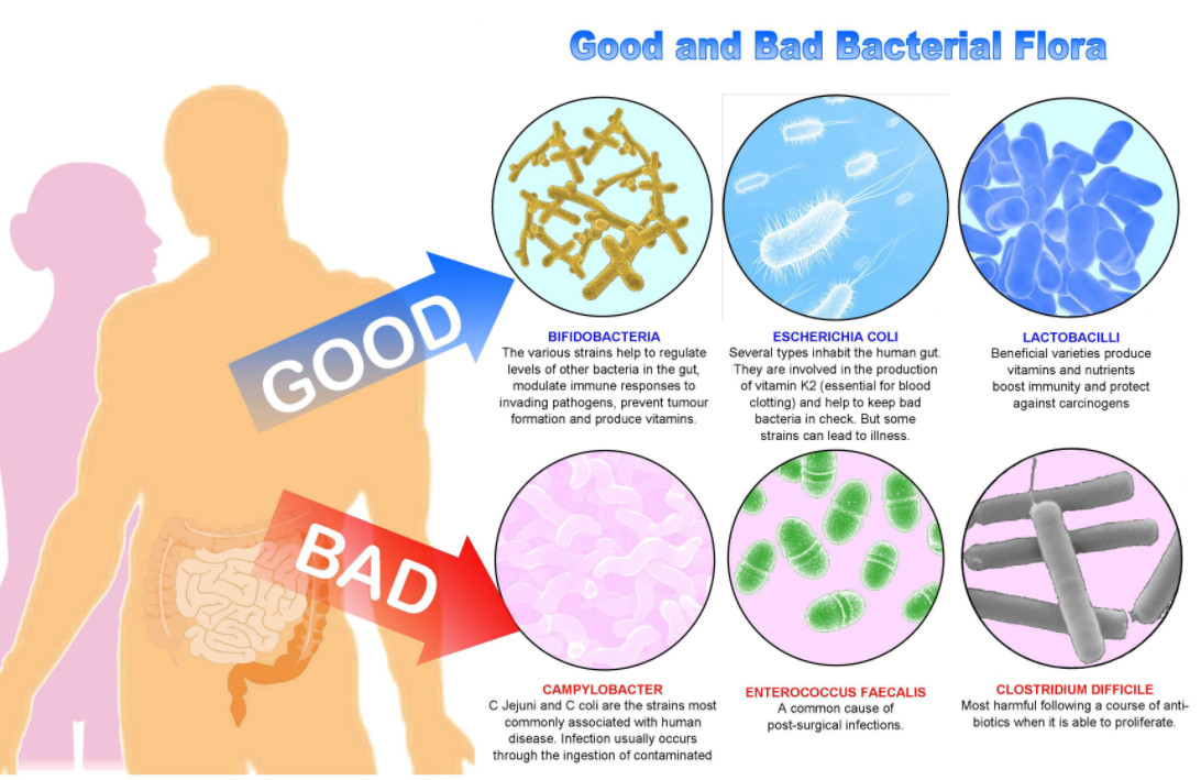 good and bad bacterial flora