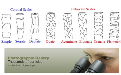 انواع کوتیکول مو زیر میکروسکوپ