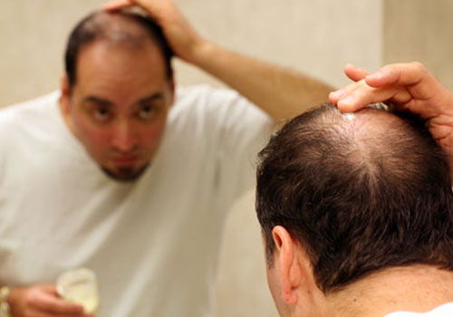 hair loss treatments og