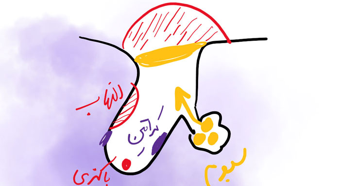 pilosebaceous unit diagram