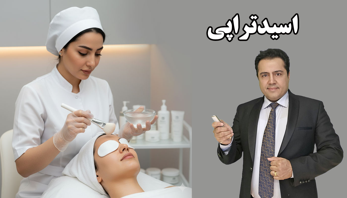 product acid therapy og