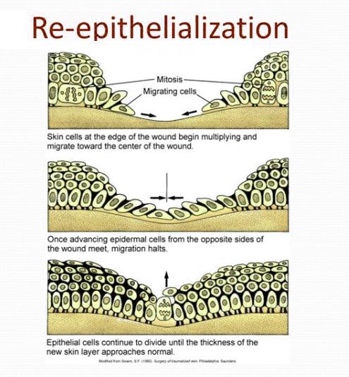 re epithelialization
