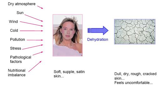 skin dehydration