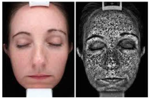 skin scanner visioface result